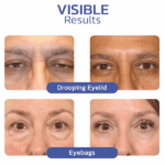 ⁦• eye cream⁩ - الصورة ⁦4⁩